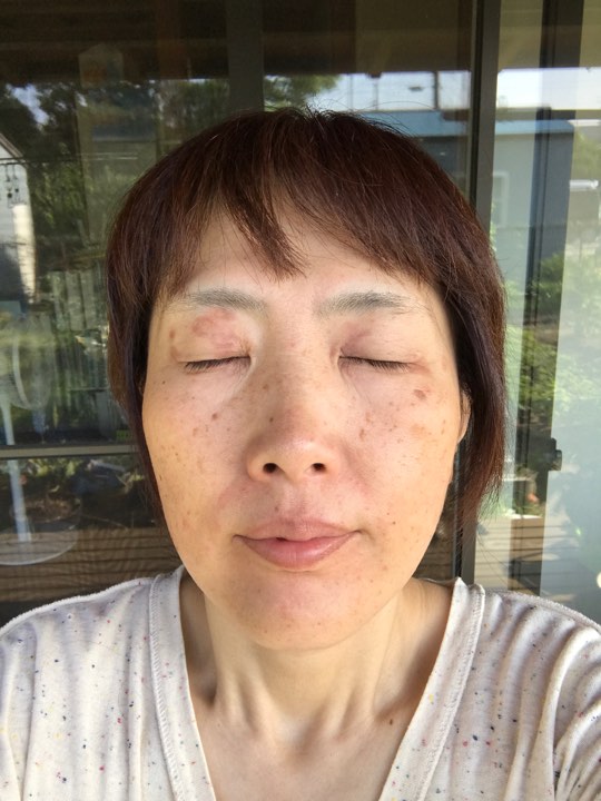 After