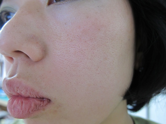 Before