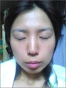 After