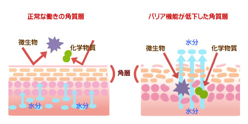アトピーの最大の原因は合成界面活性剤