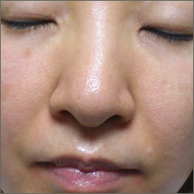 After